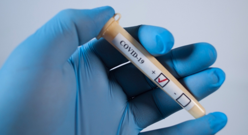 ¿Cuántos tipos de test hay para detectar la COVID-19?