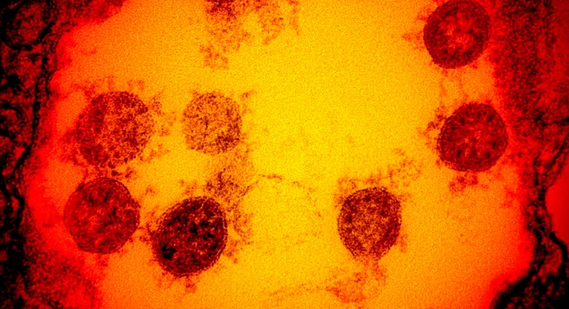 Un estudio de Harvard sugiere que la variante británica se contagia durante más de 10 días